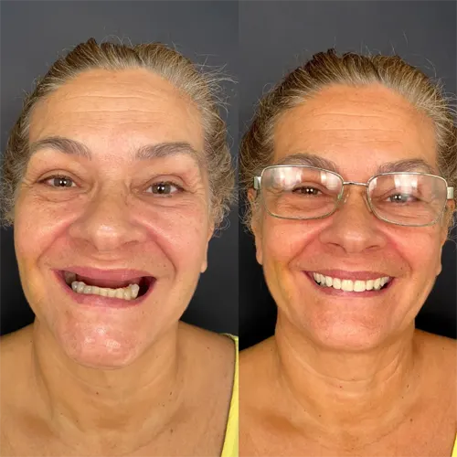 Beige Minimalist Skincare Before and After Instagram Post