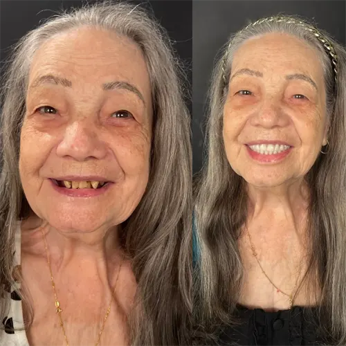 Beige Minimalist Skincare Before and After Instagram Post(1)