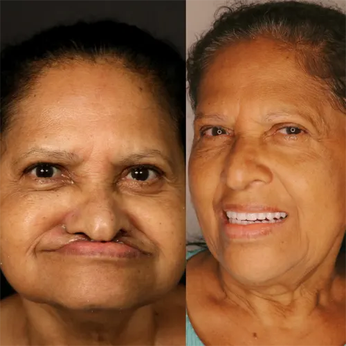 Beige Minimalist Skincare Before and After Instagram Post(2)