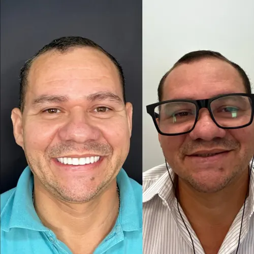 homem 40 anos antes e depois